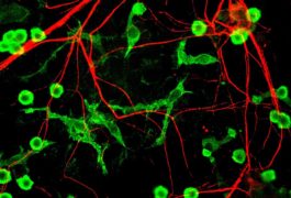 brain cells and microglia
