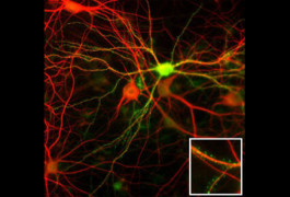 Signaling source: Mutations in neuroligins, needed for the organization of synapses, have been linked to autism.