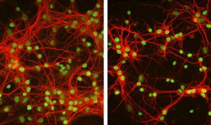 Diminished dendrites: Hippocampal neurons grown on a bed of astrocytes that lack MeCP2 have fewer and shorter dendrites (right), compared with those grown on normal astrocytes (left).