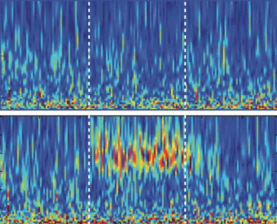 Brain bursts: Neurons engineered to respond to light (bottom) produce high-frequency brain waves that have been linked to autism.