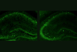 High fidelity: Compared with controls (left), mice lacking CNTNAP2 (right) have fewer interneurons, which dampen electrical signaling in the brain.