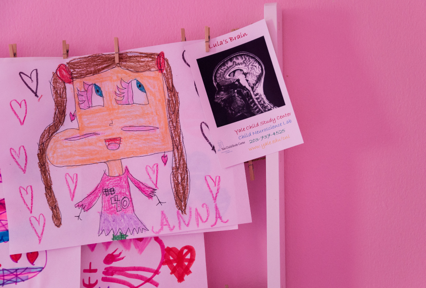 Girl brain: There are intriguing hints that in girls with autism, the social brain works differently than it does in boys with the condition. Photographs by Christina Pye 