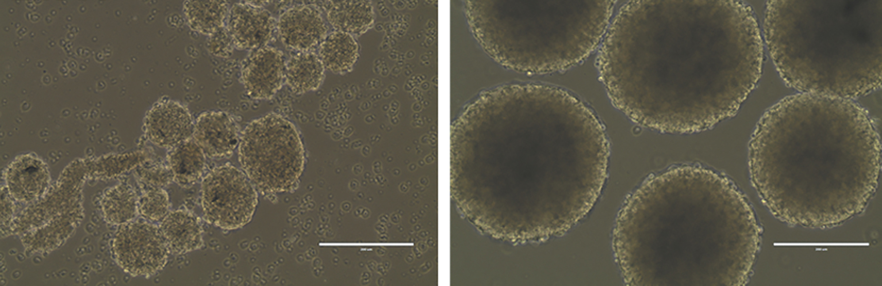Cell death: Clusters of brain cells grown in culture that have been infected with the Zika virus (left) are much smaller than uninfected spheres (right).