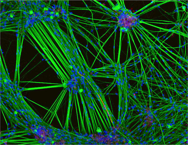 Neurons derived from skin cells (green with blue nuclei) mingle with another type of brain cell, called Schwann cells (red). Image by Rebecca Nutbrown of Oxford University.