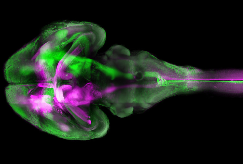 Different nerve tracts glow green and purple in a transparent mouse brain.