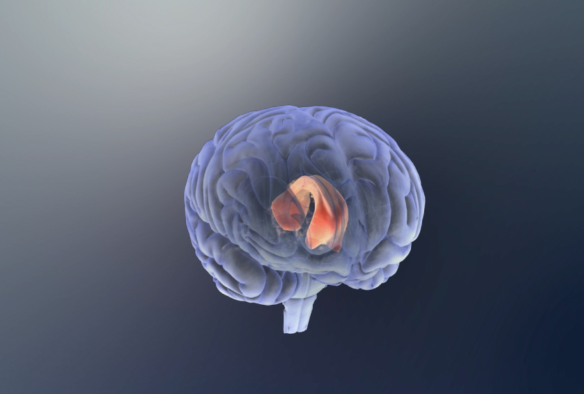 human brain showing the corpus callosum highlighted