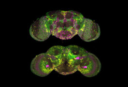 luorescent probes mark the expression patterns of three genes in a transparent fruit fly brain.