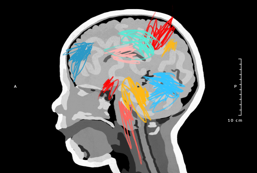 Illustration shows a cross section of a child's head with colorful scribbles on the brain.