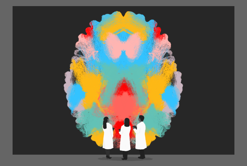 Illustration shows doctors standing in front of a top-down view of a brain, rendered in colorful scribbles.