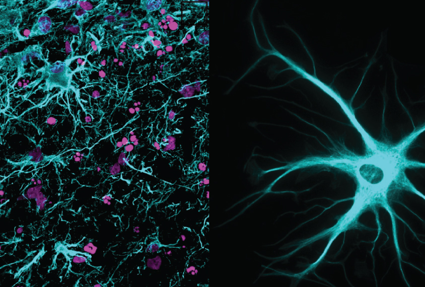 After months in culture, stem cells (left) develop into mature brain cells, including star-shaped astrocytes (right).