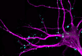 Microscope image of neuronal injections in brain.