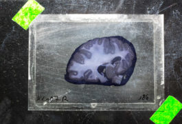 Brain bank slice of brain in lab