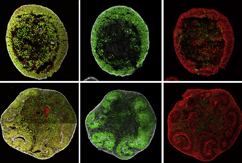 Mini-brains made from stem cells contain several types of cells found in developing human brains.