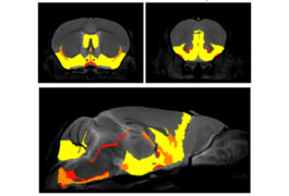 Brain regions (yellow) altered by missing immune genes correlate with those involved in anxiety.
