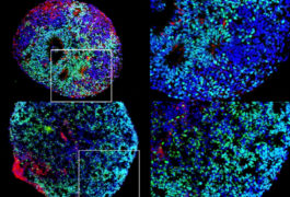 Organoids derived from fetal bone recapitulate brain development over the first 16 weeks of gestation.