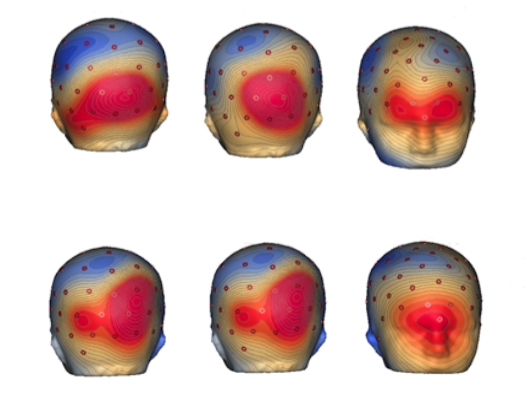six scans of brains showing various active regions highlighted