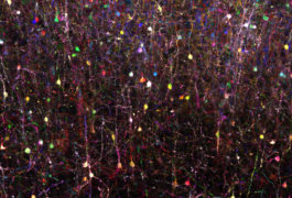 By painting individual neurons distinct colors, researchers can follow the cells more easily.