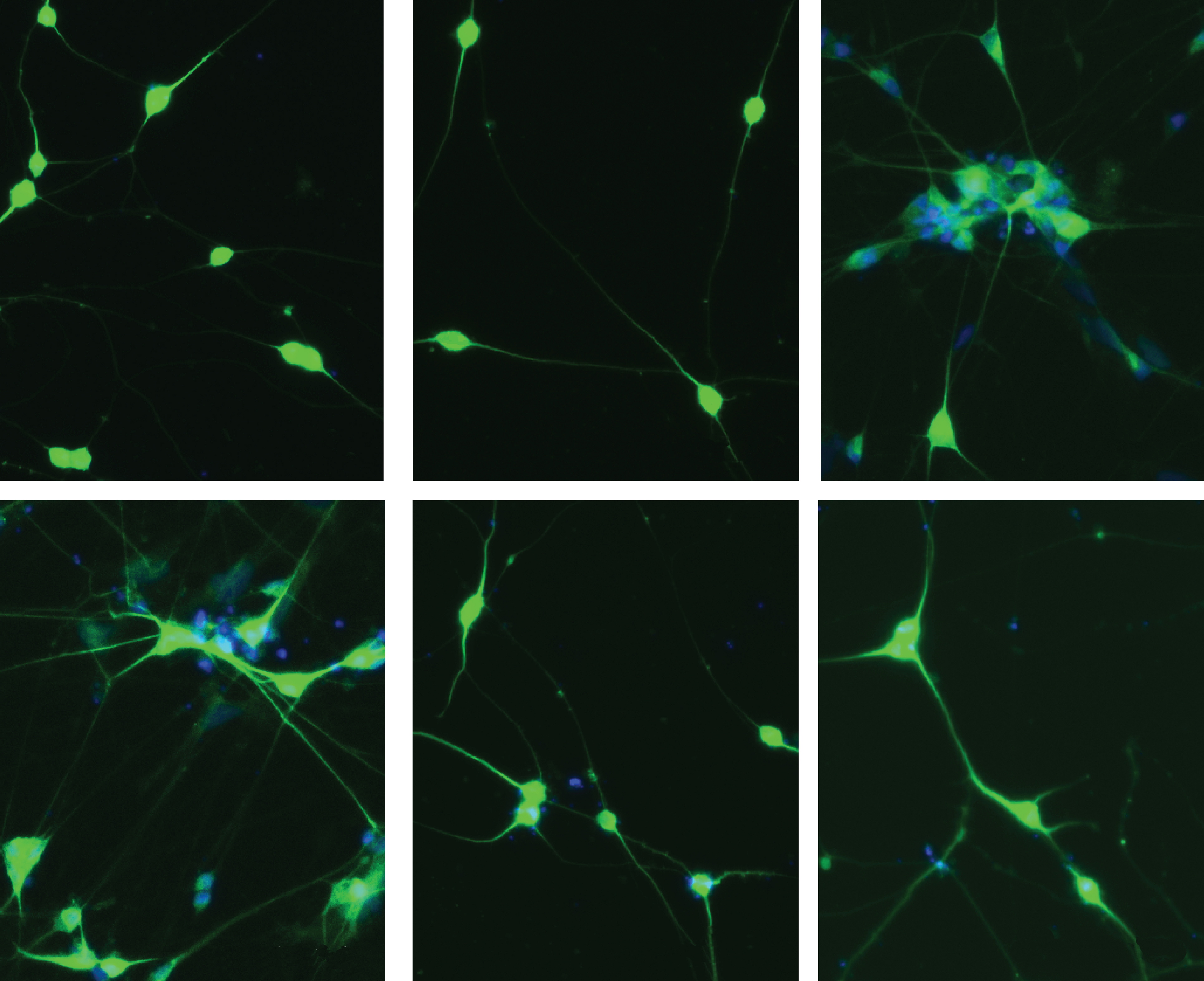 Neurons (green) generated from a human stem-cell line carry one of six mutations associated with schizophrenia, autism or intellectual disability.