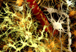 Microglia (white), the brain’s resident immune cells, have been implicated in autism.