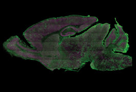 Neurons in a mouse brain glow green after a virus carrying specialized molecular tools edits their genomes.