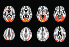 eight brains with various sections highlighted