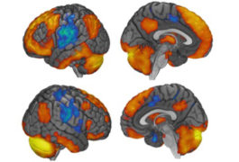 four brains with the RCrusl section highlighted