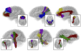 six brain slices with birdseye view of brains