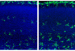 Male fetal mice that lack a microbiome have more microglia (green, right) in certain brain regions than controls do (left).