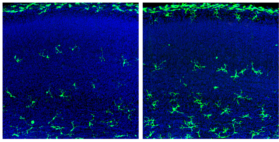 Male fetal mice that lack a microbiome have more microglia (green, right) in certain brain regions than controls do (left).