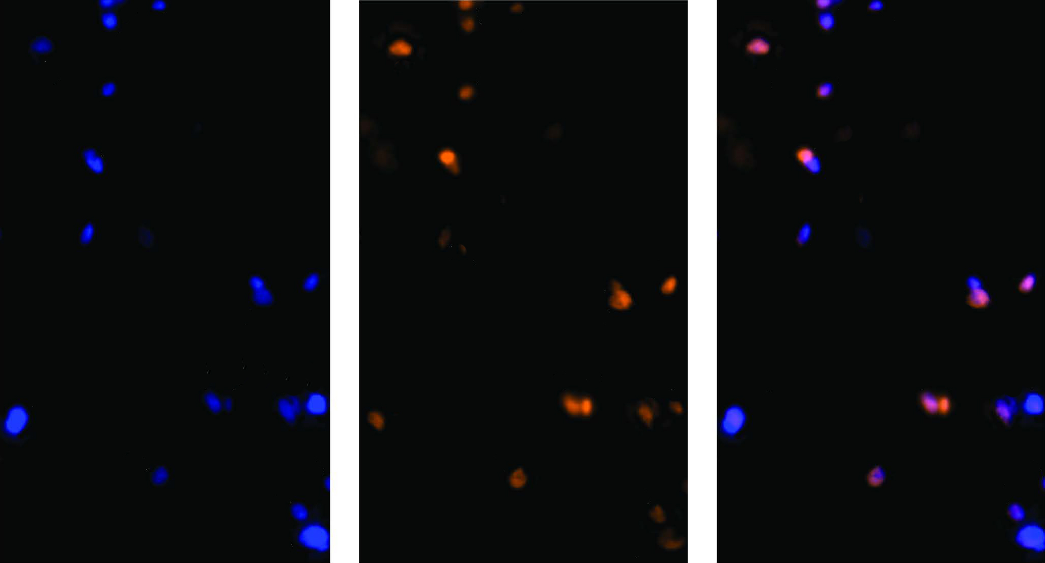 By staining the nuclei from all cells blue (left) and those from neurons red (middle), researchers can isolate the resulting purple nuclei from neurons (right).