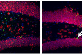 Mice lacking one copy of MEF2C have fewer neurons (red and green, right) in the hippocampus than controls do (left).