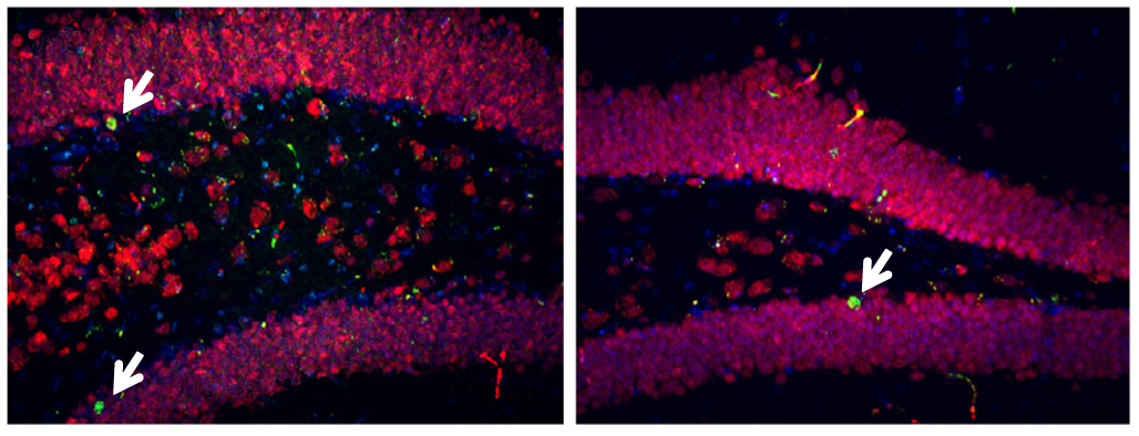 Mice lacking one copy of MEF2C have fewer neurons (red and green, right) in the hippocampus than controls do (left).