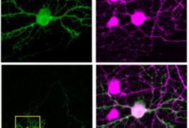 A single neuron glows green after light stimulates it, whereas its neighbors (magenta) remain inactive.