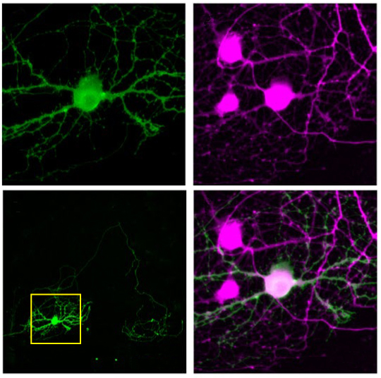 A single neuron glows green after light stimulates it, whereas its neighbors (magenta) remain inactive.