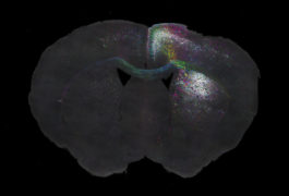 slice of mouse brain showing neuron connection
