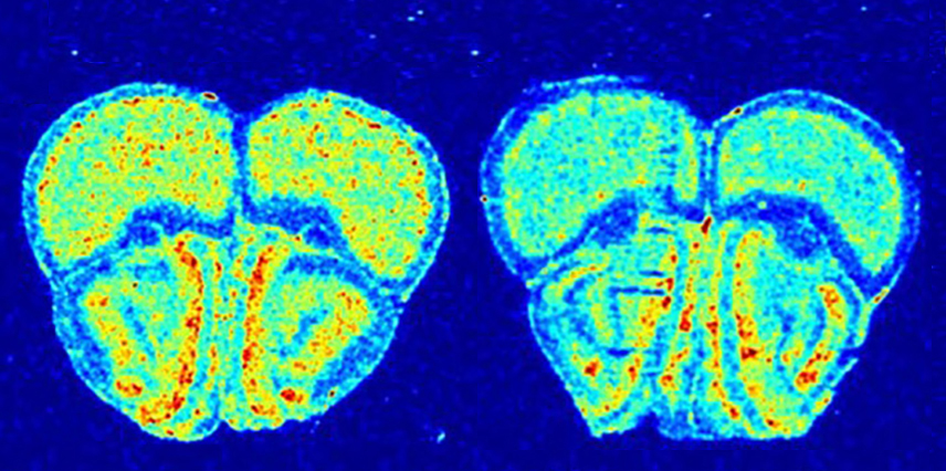 A mouse model of tuberous sclerosis (right) shows less protein synthesis in the brain than a control (left).