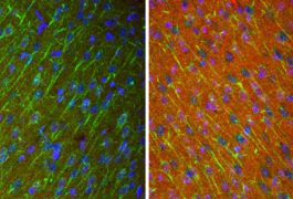 A cancer drug boosts levels of a key protein (red) in mice lacking SHANK3.