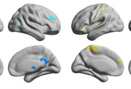 eight brains with different regions highlighted