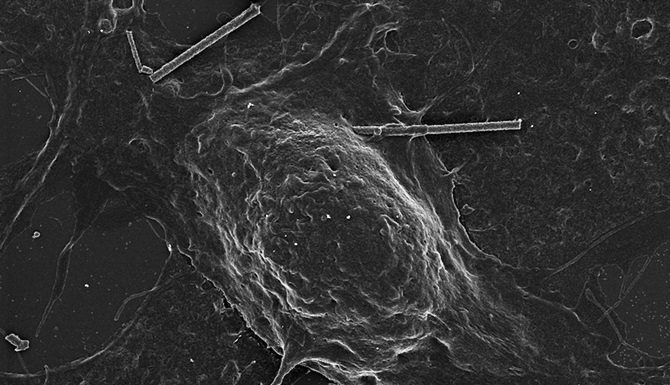A silicon nanowire touches the membrane of a rat neuron.